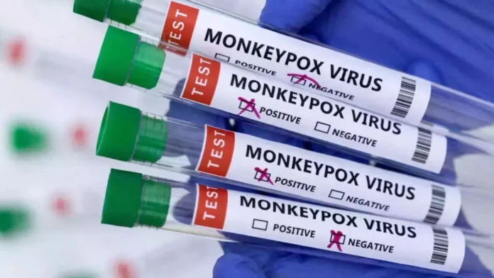 Health specialist urges public vigilance to contain Monkeypox outbreak