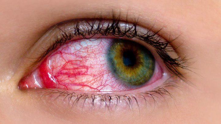 Awarness for limited use of digital devices, timely detection keys to control rising number of eye cancer in Kids: Experts