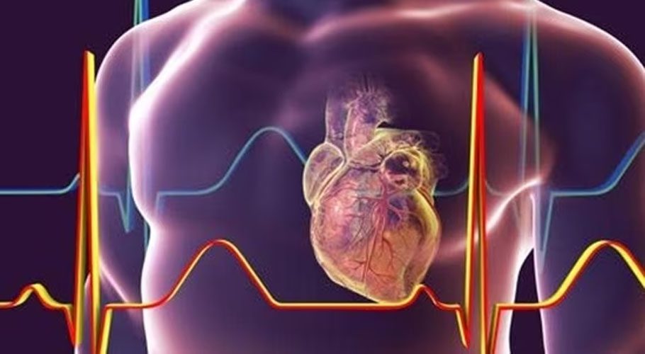 Cardiac diseases in youth increasing like epidemic, warn experts