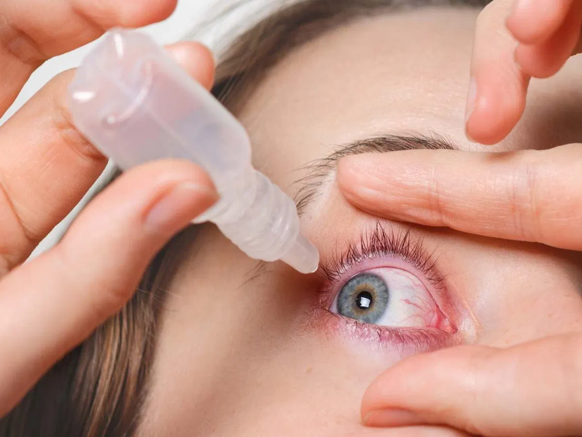 Expert warn self-medication for ‘conjunctivitis’, awareness stresses